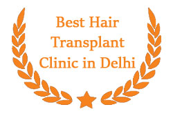 Best Hair Transplant Clinic in Delhi