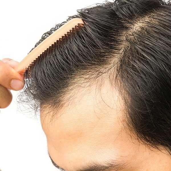 Awarded Best Hair Transplant Clinic in Delhi NCR