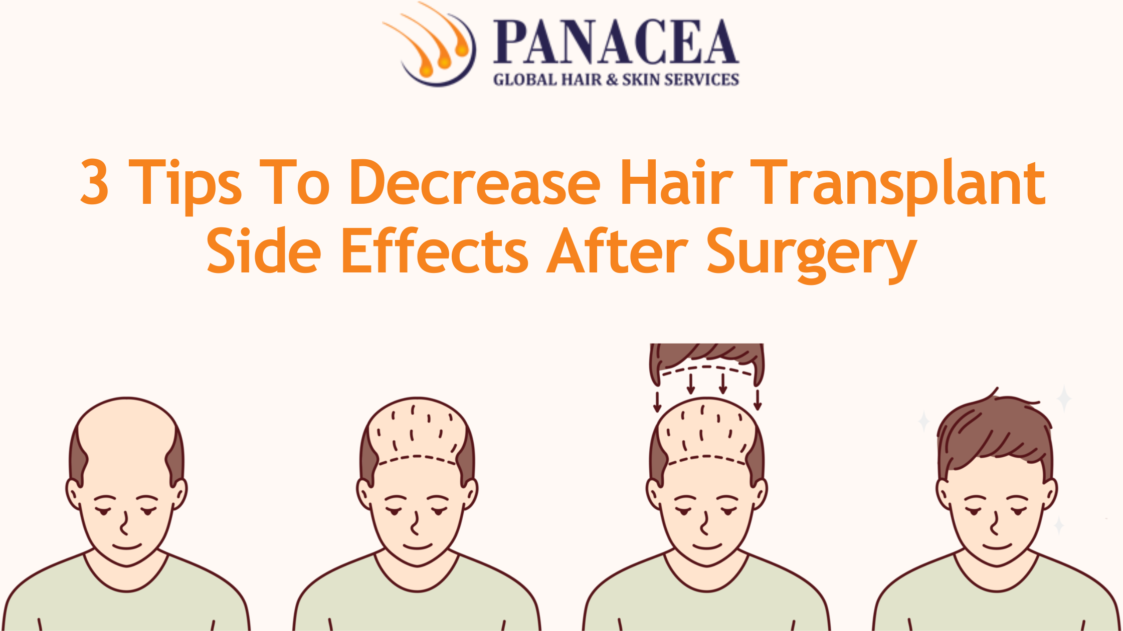 3 Tips To Decrease Hair Transplant Side Effects After Surgery