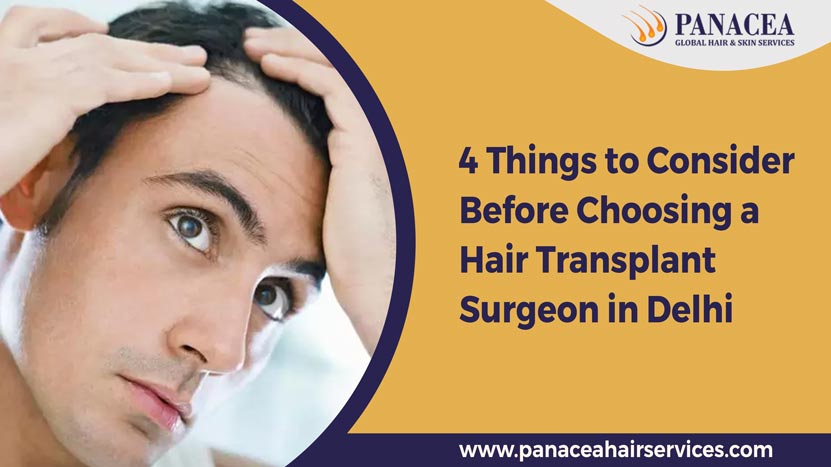 4 Things to Consider Before Choosing a Hair Transplant Surgeon in Delhi