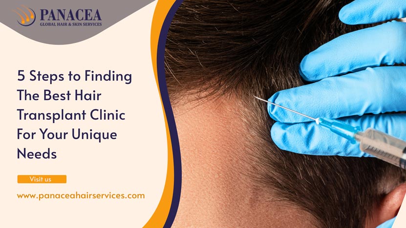 5 Steps to Finding the Best Hair Transplant Clinic for Your Unique Needs