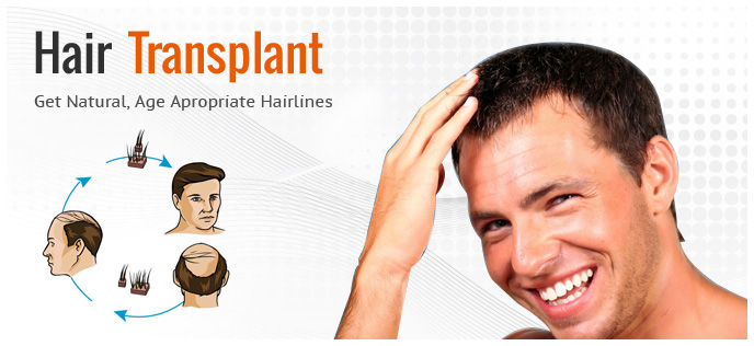 Advantages of Hair Transplant