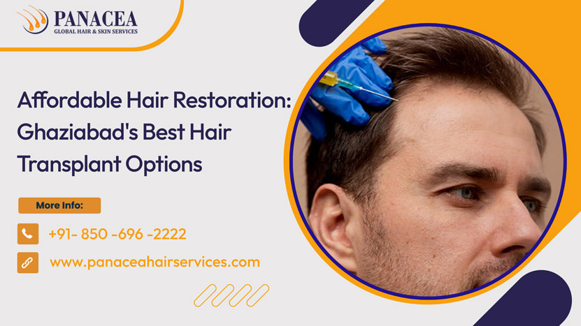 Affordable Hair Restoration Ghaziabads Best Hair Transplant Options