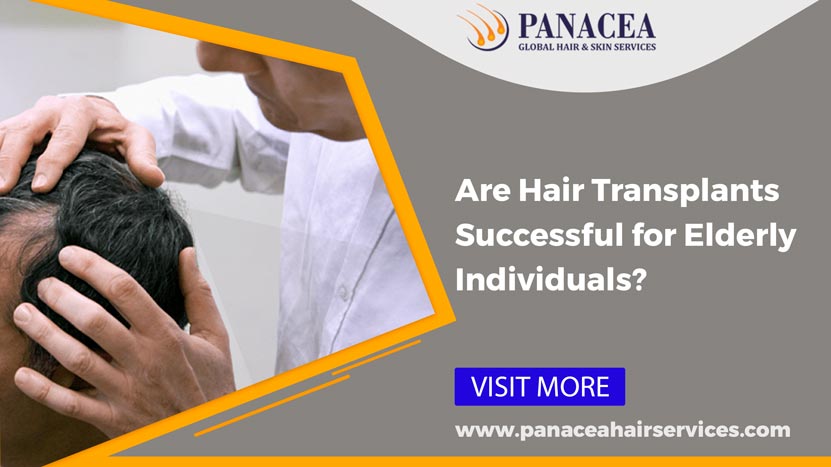 Are Hair Transplants Successful for Elderly Individuals