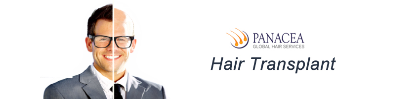 Basics of Hair Transplant Explained