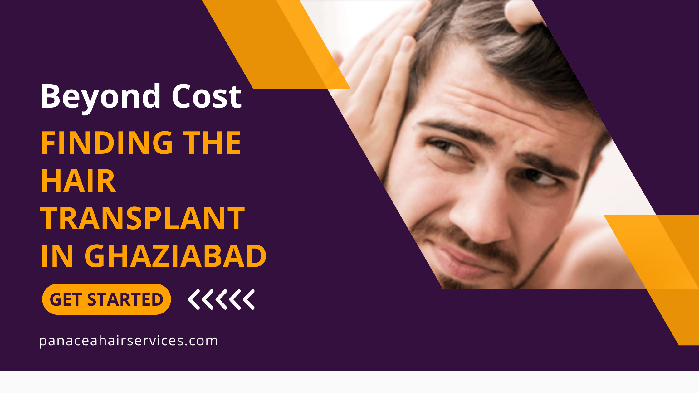 Beyond Cost Finding the Hair Transplant in Ghaziabad
