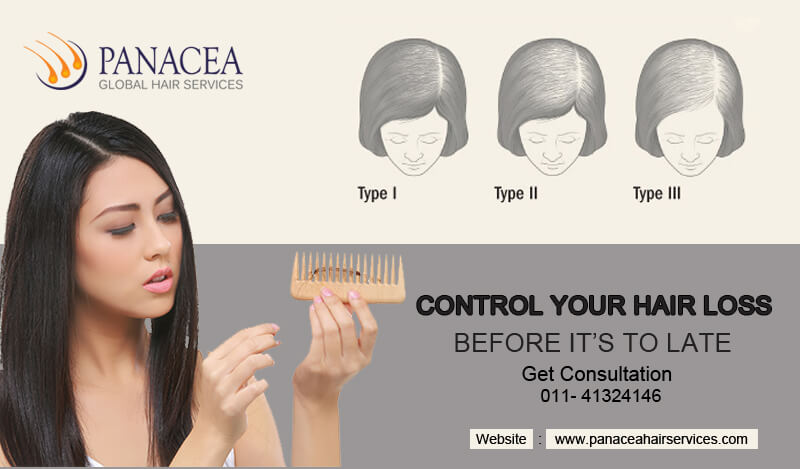 Bringing Changes in Your Lifestyle To Counter Hair Fall Issues