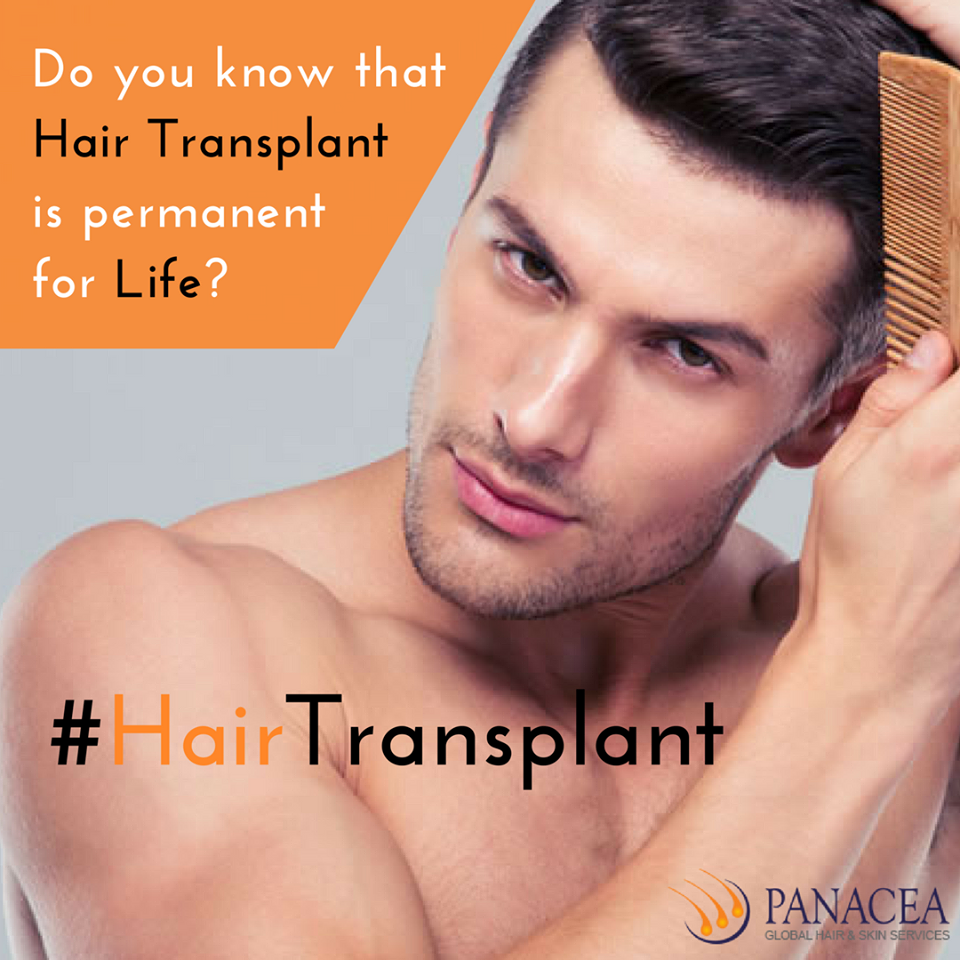 Commonly Asked Questions about Hair Transplant