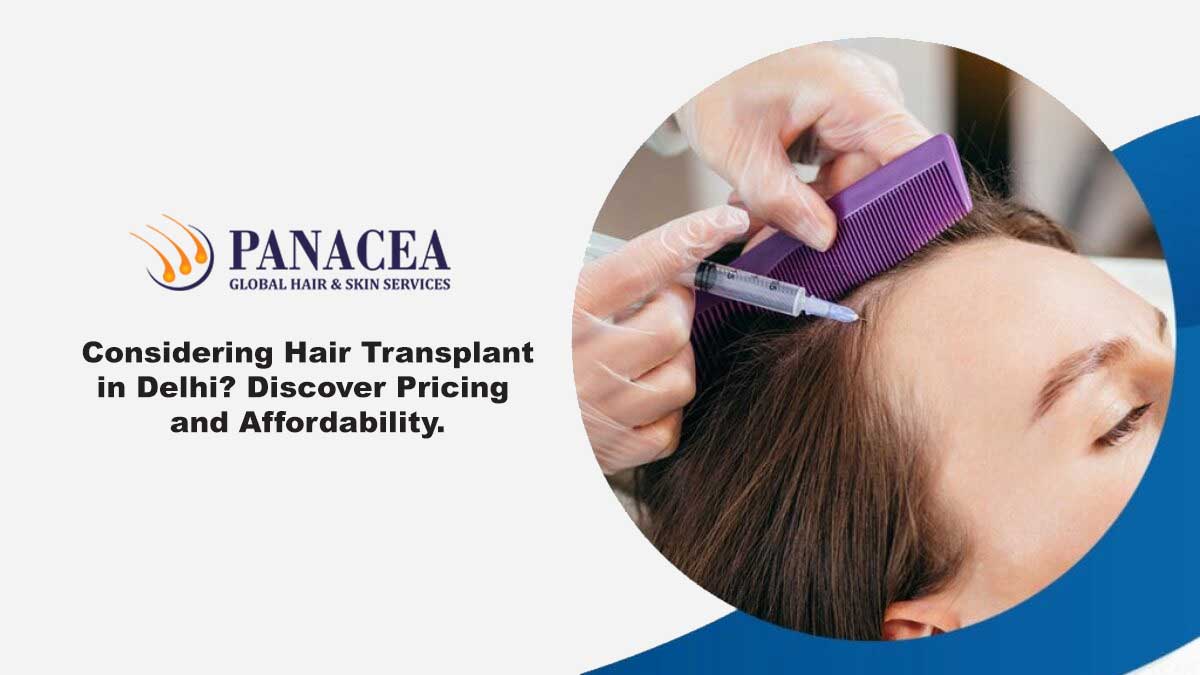 Considering Hair Transplant in Delhi Discover Pricing and Affordability