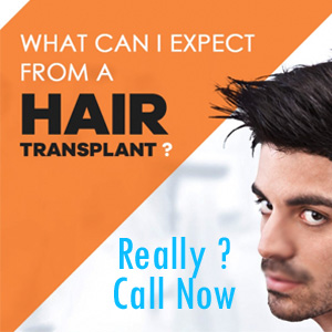 Do not Let Down Your Spirits Due To Hair Troubles Consult the Experts