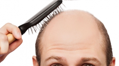 Get Cured of Baldness Today