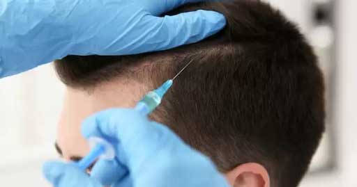 Get a New Look and Boost Your Confidence with Hair Transplantation