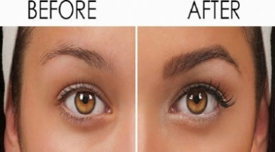 Get the solution for thinning of eyebrows