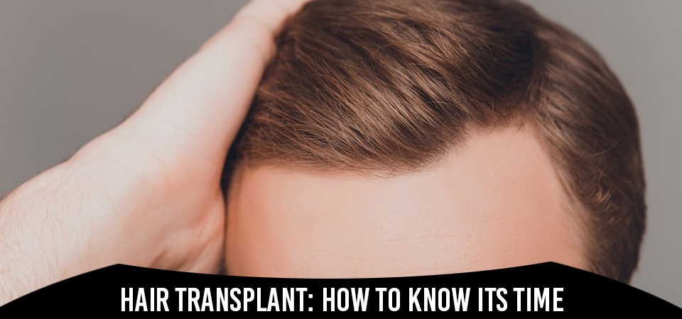 Hair Transplant: How To Know Its Time