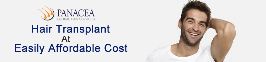 How To Determine Hair Transplant Cost In Delhi