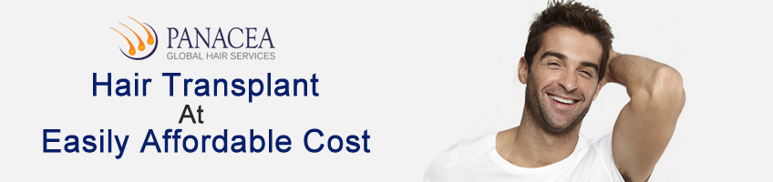 Important Factors To Determine The Hair Transplant Cost