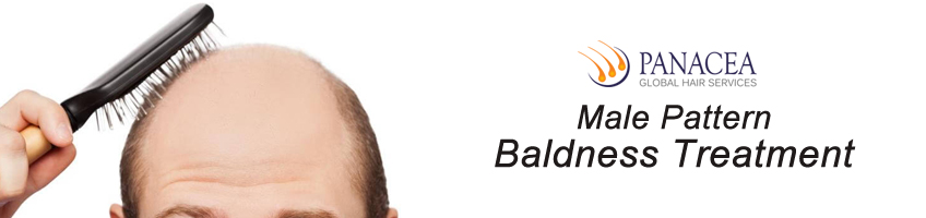 Know Your Baldness Pattern and Take Step Today