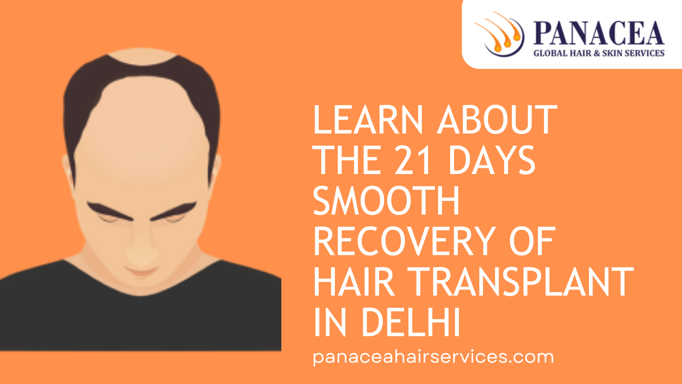 Learn About The 21 Days Smooth Recovery of Hair Transplant in Delhi