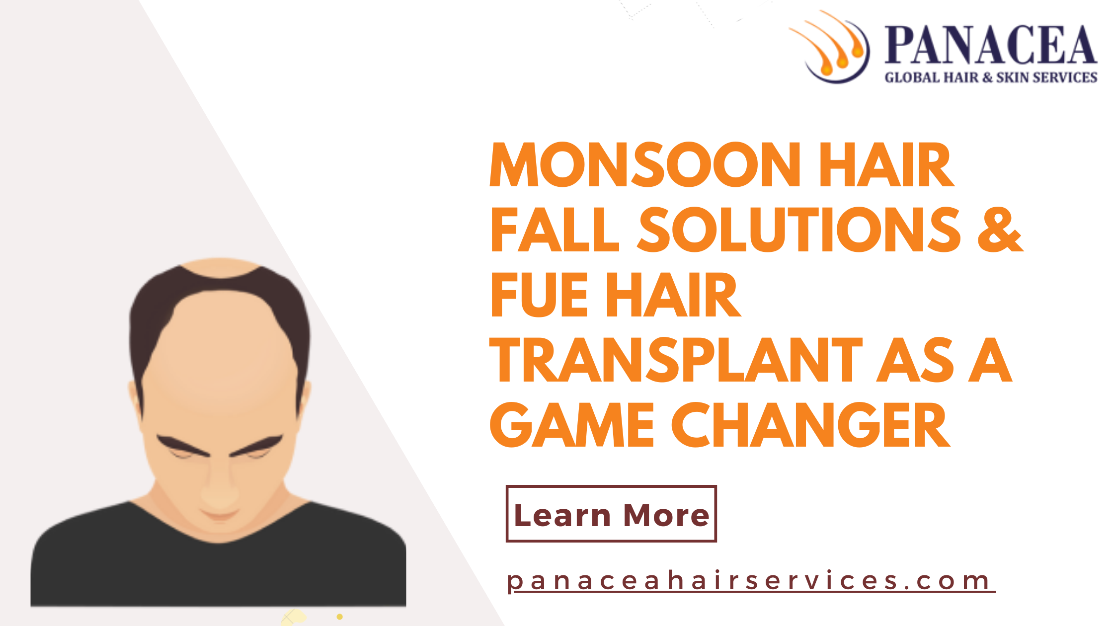 Monsoon Hair Fall Solutions or FUE Hair Transplant as a Game Changer