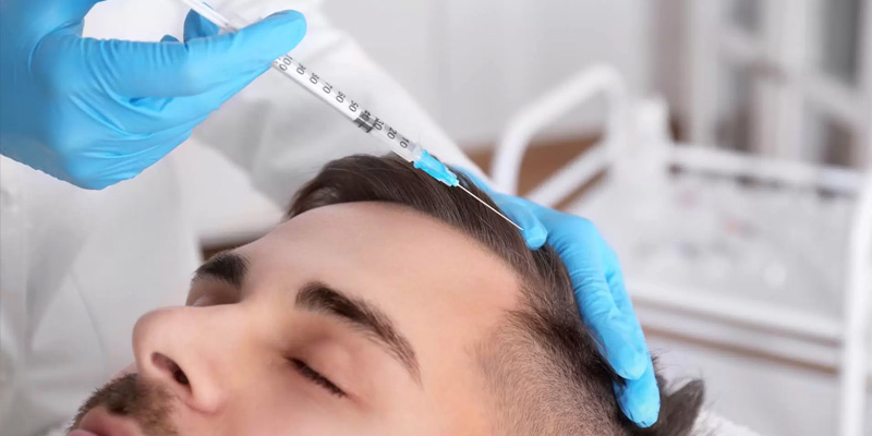 Questions to ask to your Hair Transplant Surgeon