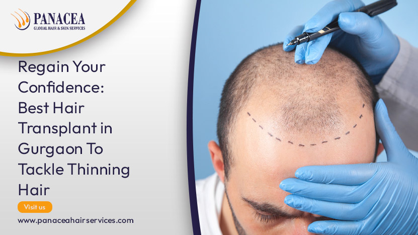 Regain Your Confidence Best Hair Transplant in Gurgaon To Tackle Thinning Hair