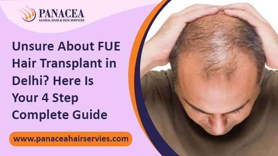 Unsure About FUE Hair Transplant in Delhi Here Is Your 4 Step Complete Guide