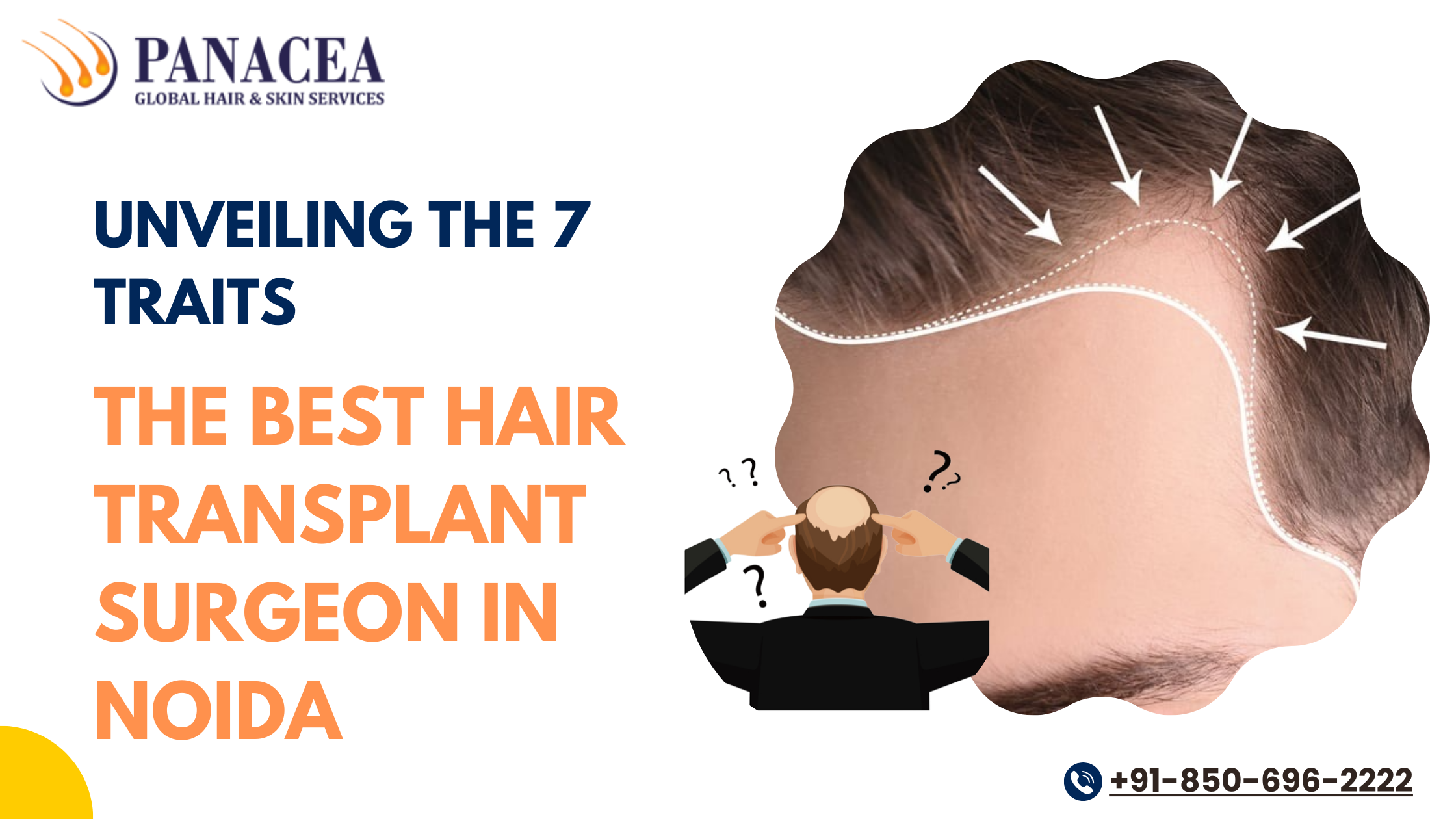 Unveiling the 7 traits Of the Best Hair Transplant Surgeon in Noida