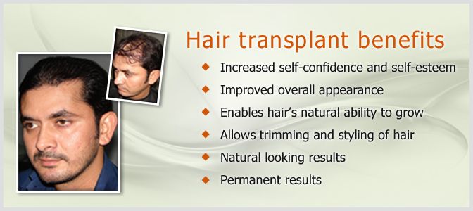 Hair Transplant