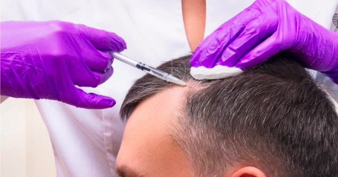 What Should You Look For When Choosing A Clinic And A Surgeon For Your Hair Transplant