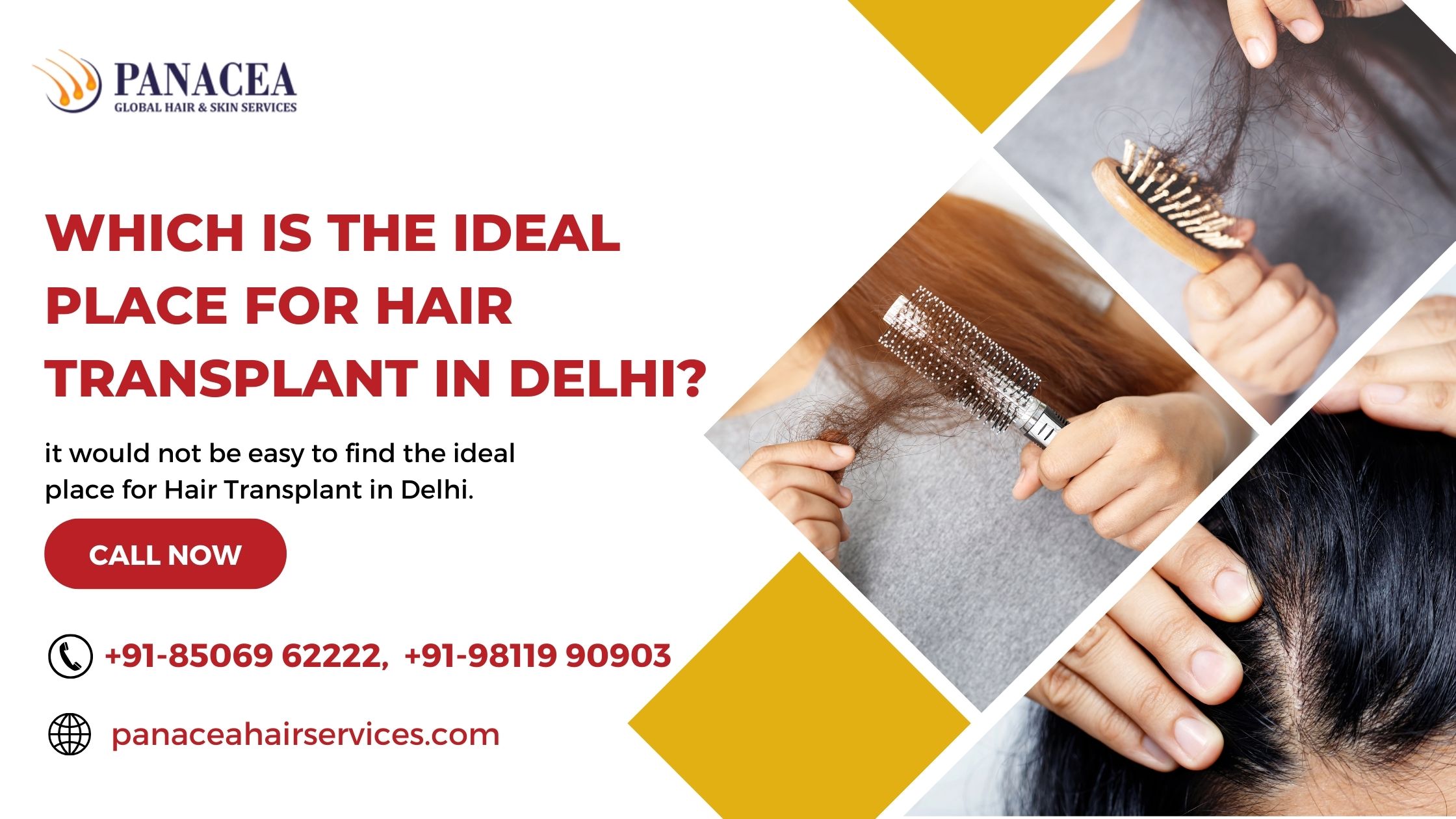 WHICH IS THE IDEAL PLACE FOR HAIR TRANSPLANT IN DELHI