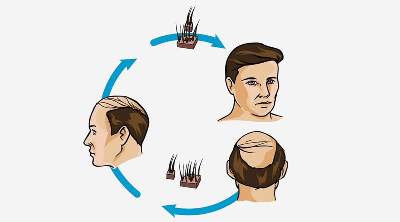 Ways to stimulate Hair Growth Services in Delhi