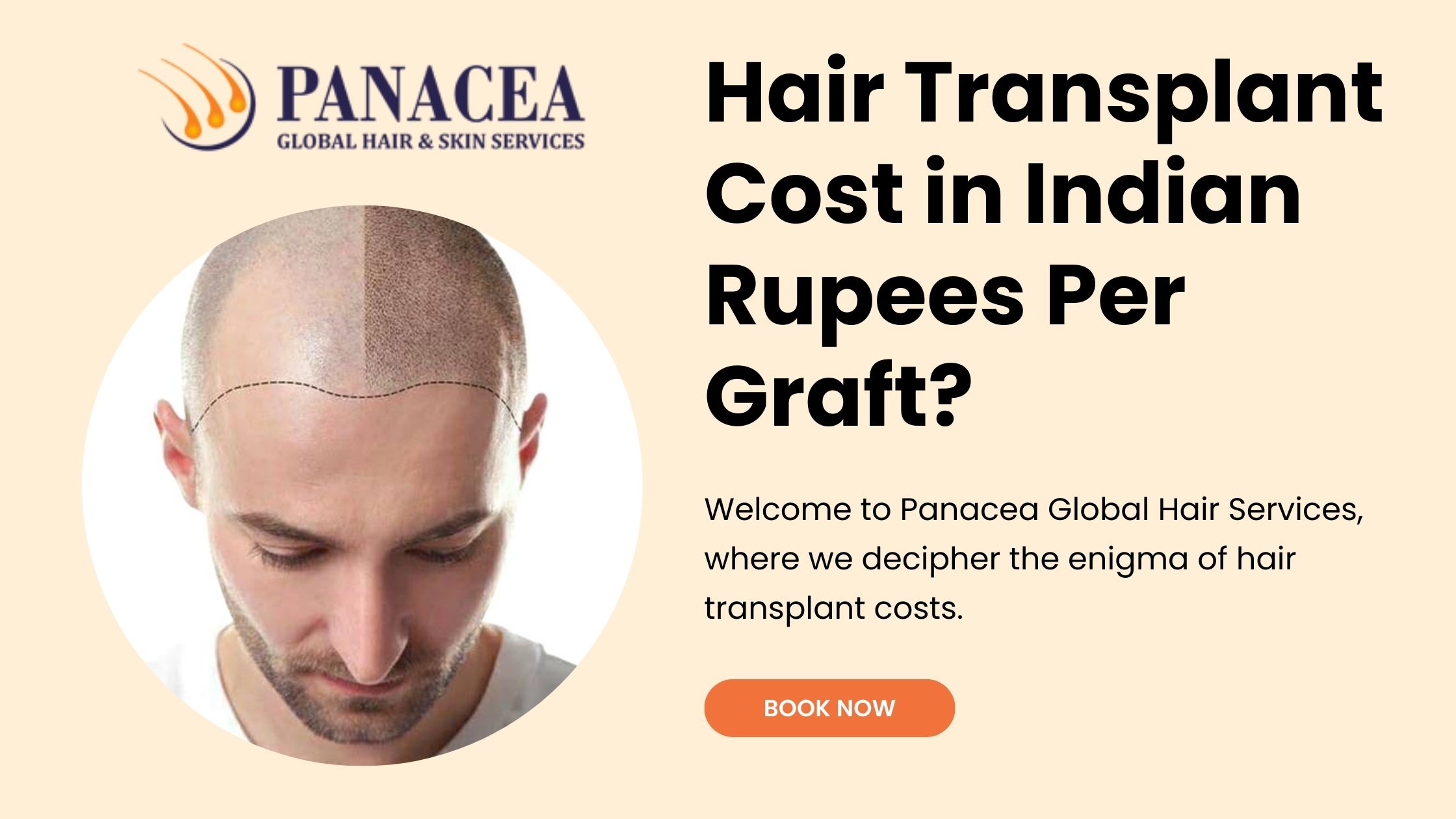 What Is The Hair Transplant Cost in Indian Rupees Per Graft