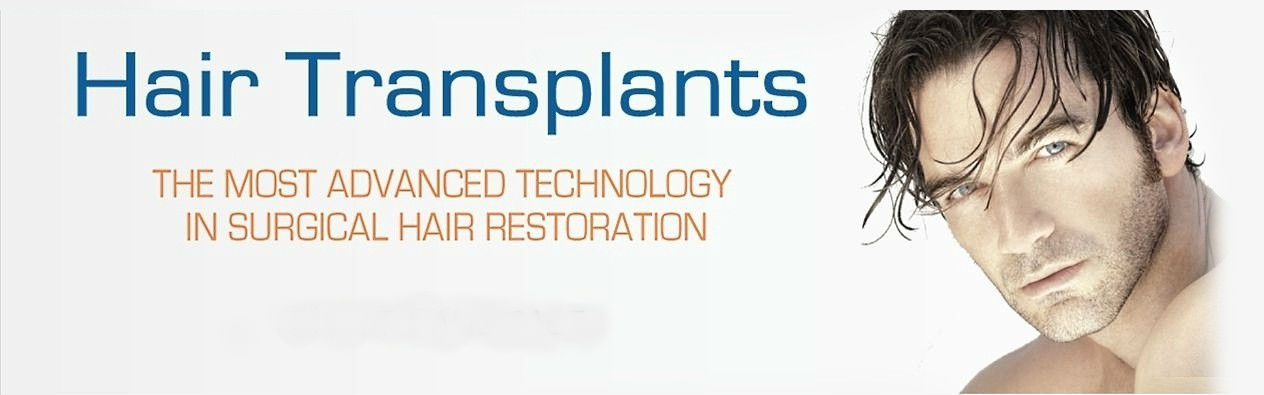 What Should You Expect from the Best Hair Transplant in Delhi