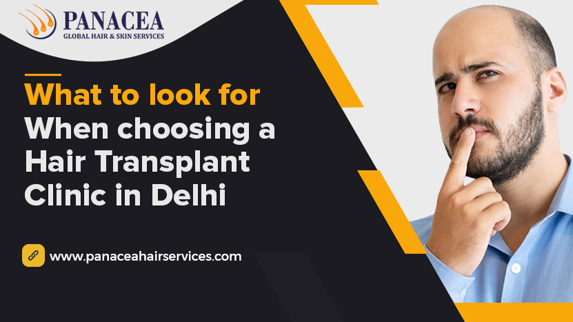 What to look for when choosing a Hair Transplant Clinic in Delhi