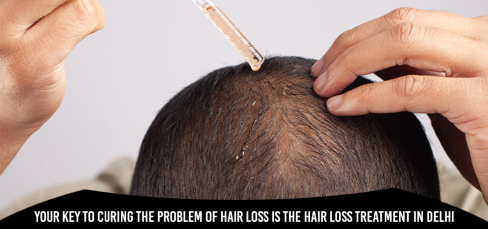 Your key to curing the problem of hair loss is the Hair loss treatment in Delhi