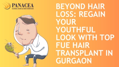 Beyond Hair Loss Regain Your Youthful Look with Top FUE Hair Transplant in Gurgaon