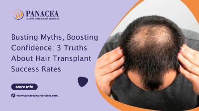 Busting Myths Boosting Confidence 3 Truths About Hair Transplant Success Rates