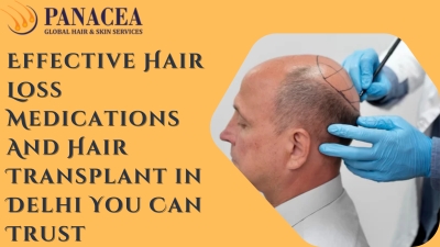Effective Hair Loss Medications And Hair Transplant in Delhi You Can Trust