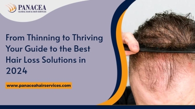 From Thinning to Thriving: Your Guide to the Best Hair Loss Solutions in 2024