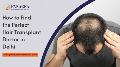 How to Find the Perfect Hair Transplant Doctor in Delhi