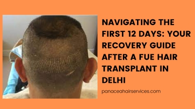 Navigating the First 12 Days Your Recovery Guide After A Fue Hair Transplant in Delhi