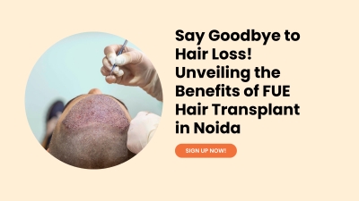 Say Goodbye to Hair Loss! Unveiling the Benefits of FUE Hair Transplant in Noida