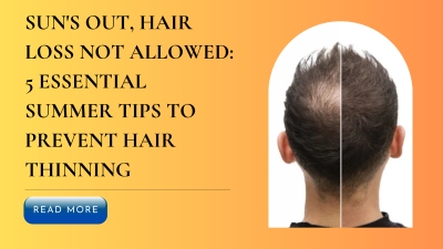 Suns Out Hair Loss Not Allowed 5 Essential Summer Tips to Prevent Hair Thinning