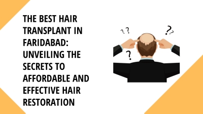 The Best Hair Transplant in Faridabad Unveiling the Secrets to Affordable and Effective Hair Restoration