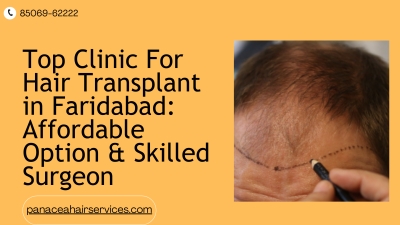 Top Clinic For Hair Transplant in Faridabad Affordable Option and Skilled Surgeon