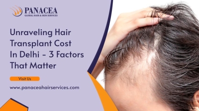 Unraveling Hair Transplant Cost in Delhi 3 Factors that Matter