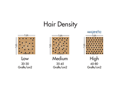 How many Grafts do you need for a Maximum Density Follicle Implant?