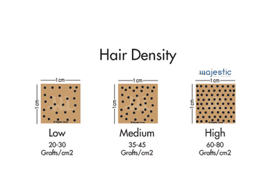 How many Grafts do you need for a Maximum Density Follicle Implant?