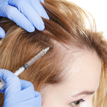 Women Hair Transplant in Delhi