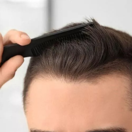 Repair Hair Transplant Treatment Delhi-NCR